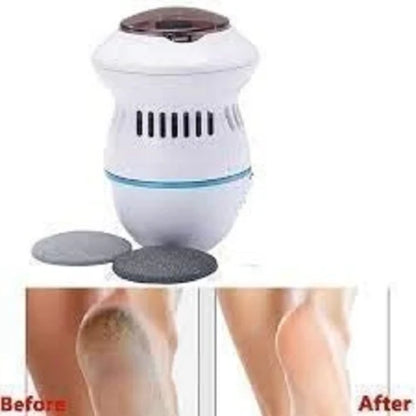 Motorized Foot Care Device